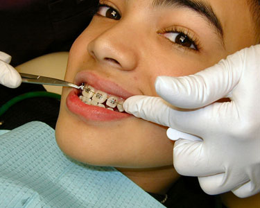 Kids Lee County and Charlotte County: Orthodontists - Fun 4 Fort Myers Kids